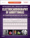 Electrocardiography of Arrhythmias: A Comprehensive Review