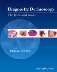 Diagnostic Dermoscopy