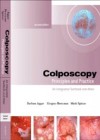 Colposcopy