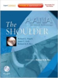 AANA Advanced Arthroscopy: The Shoulder