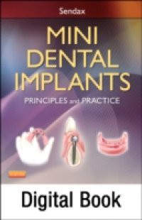 Mini Dental Implants