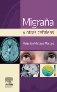 Migrana y otras cefaleas