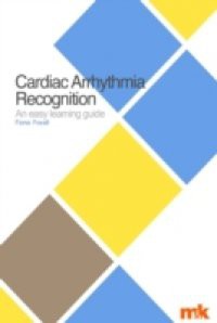 Cardiac Arrhythmia Recognition