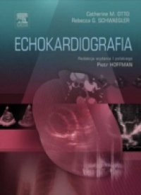 Echokardiografia, Otto