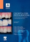 Odontologia restauradora