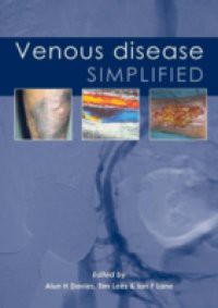 Venous Disease Simplified