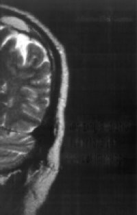 IONIZING RADIATION DETECTORS FOR MEDICAL IMAGING