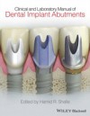 Clinical and Laboratory Manual of Dental Implant Abutments