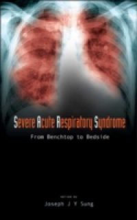 SEVERE ACUTE RESPIRATORY SYNDROME (SARS)