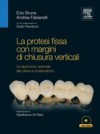 La protesi fissa con margini di chiusura verticali