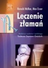 Leczenie zlaman